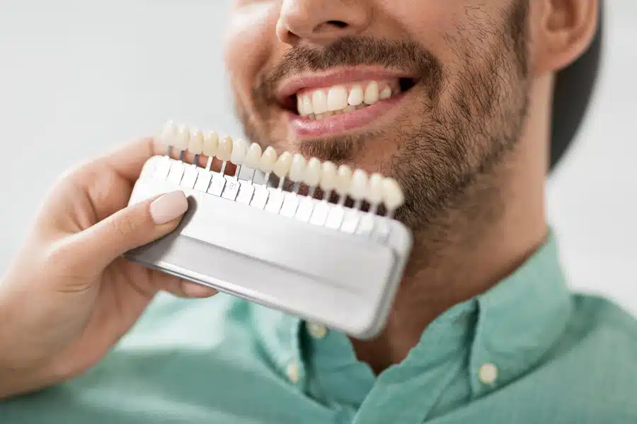 A man with a beard smiles while a dental professional holds a set of tooth color samples to his mouth, checking for a color match.