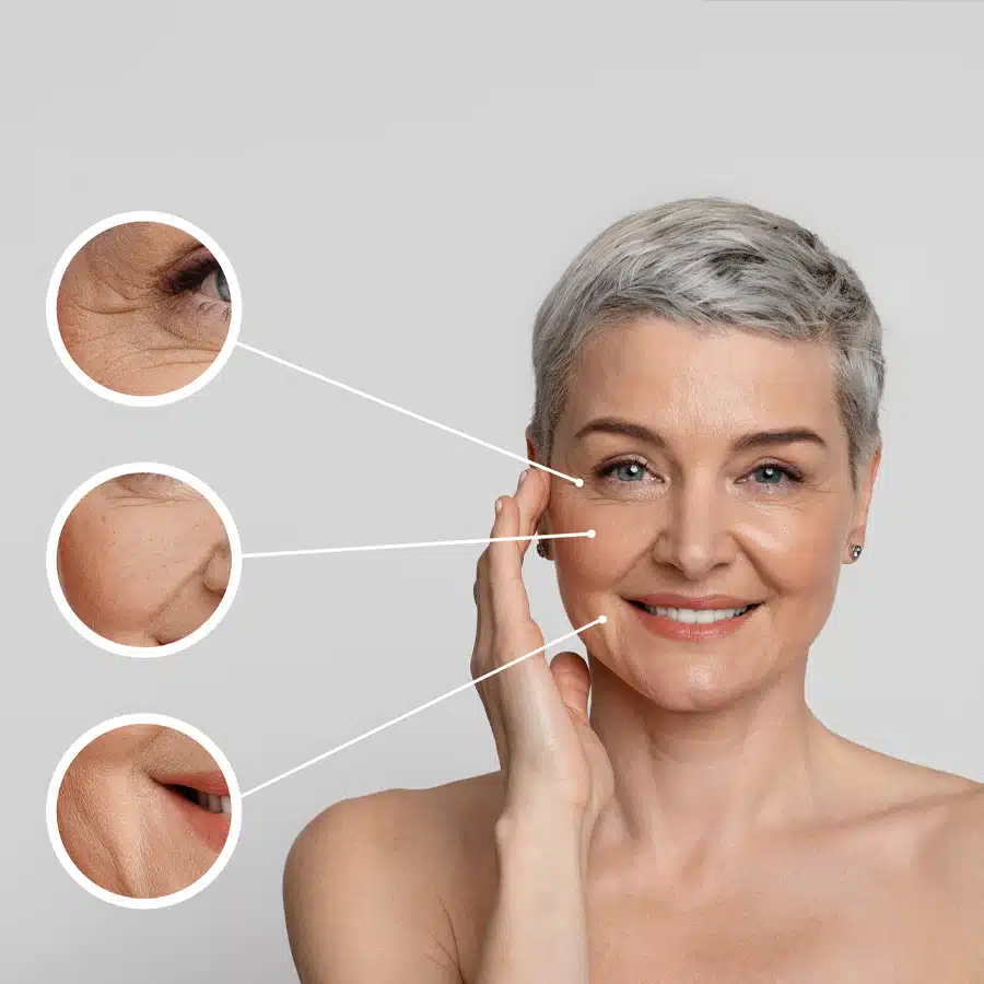 A woman displaying facial wrinkles, emphasizing the skin benefits of Halotherapy and Red Light Therapy at iVee Restorative Care.