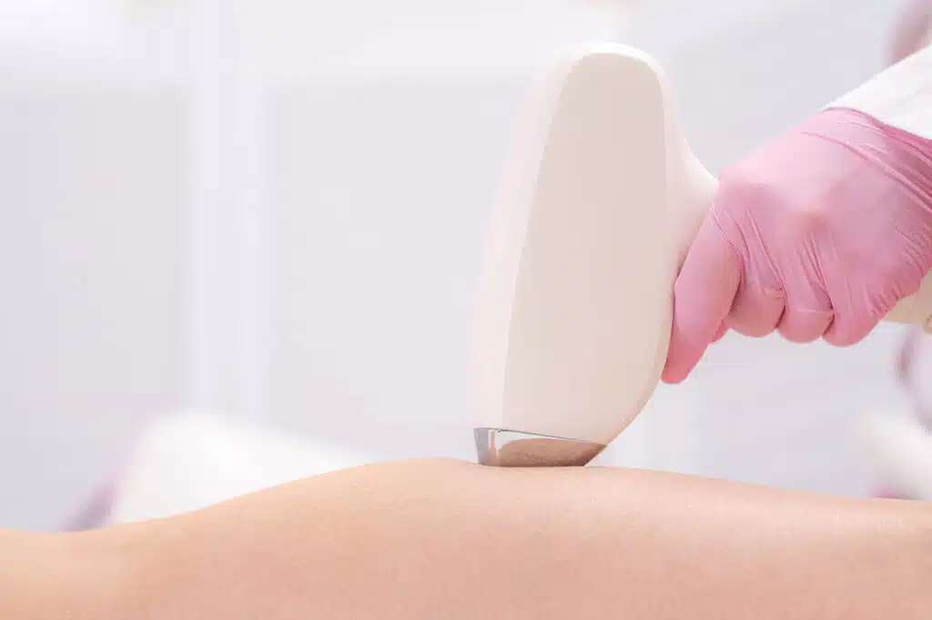 A person with pink gloves uses a laser hair removal device on a patient's leg in a clinical setting, conveying a sense of precision and care.